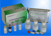 Ⅰ型和Ⅱ型单纯疱疹病毒IgG抗体检测试剂盒