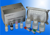 Ⅱ型单纯疱疹病毒IgG抗体检测试剂盒