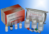 巨细胞病毒IgM抗体检测试剂盒(捕获法)