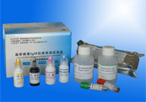 麻疹病毒IgM抗体检测试剂盒（捕获法）