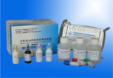 弓形虫IgM抗体检测试剂盒(捕获法)
