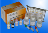 风疹病毒IgM抗体检测试剂盒(捕获法)