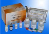 风疹病毒IgM抗体检测试剂盒